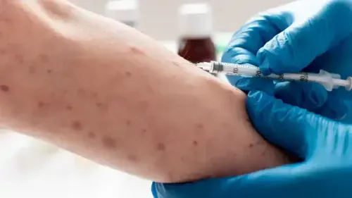 What is Tetanus Disease?